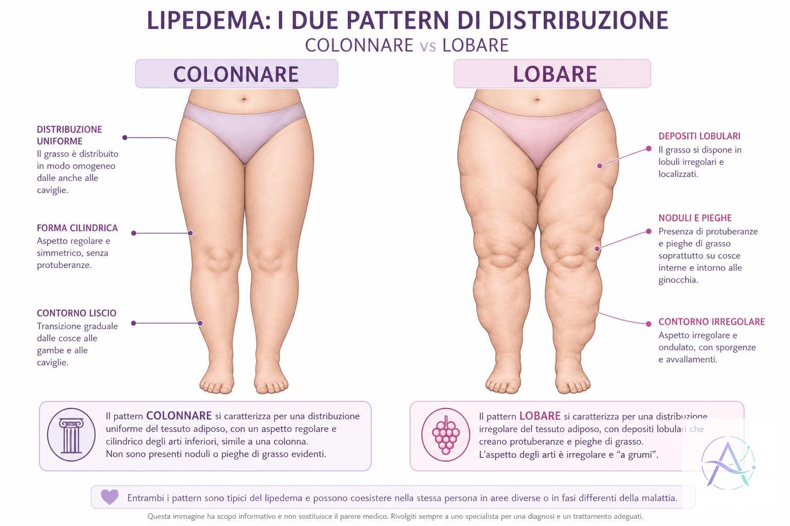 Distribuzione: colonnare vs lobare